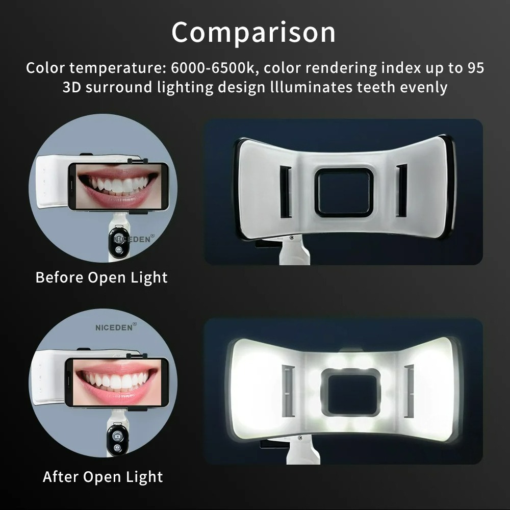 Luz de Fotografía Dental para  - Photography Dental reseña y precio